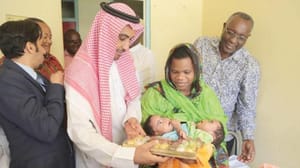 تنزانیا کے جڑوا بچوں کے علاج کے سلسلہ میں خادم حرمین شریفین کی طرف سے شاہی فرمان جاری